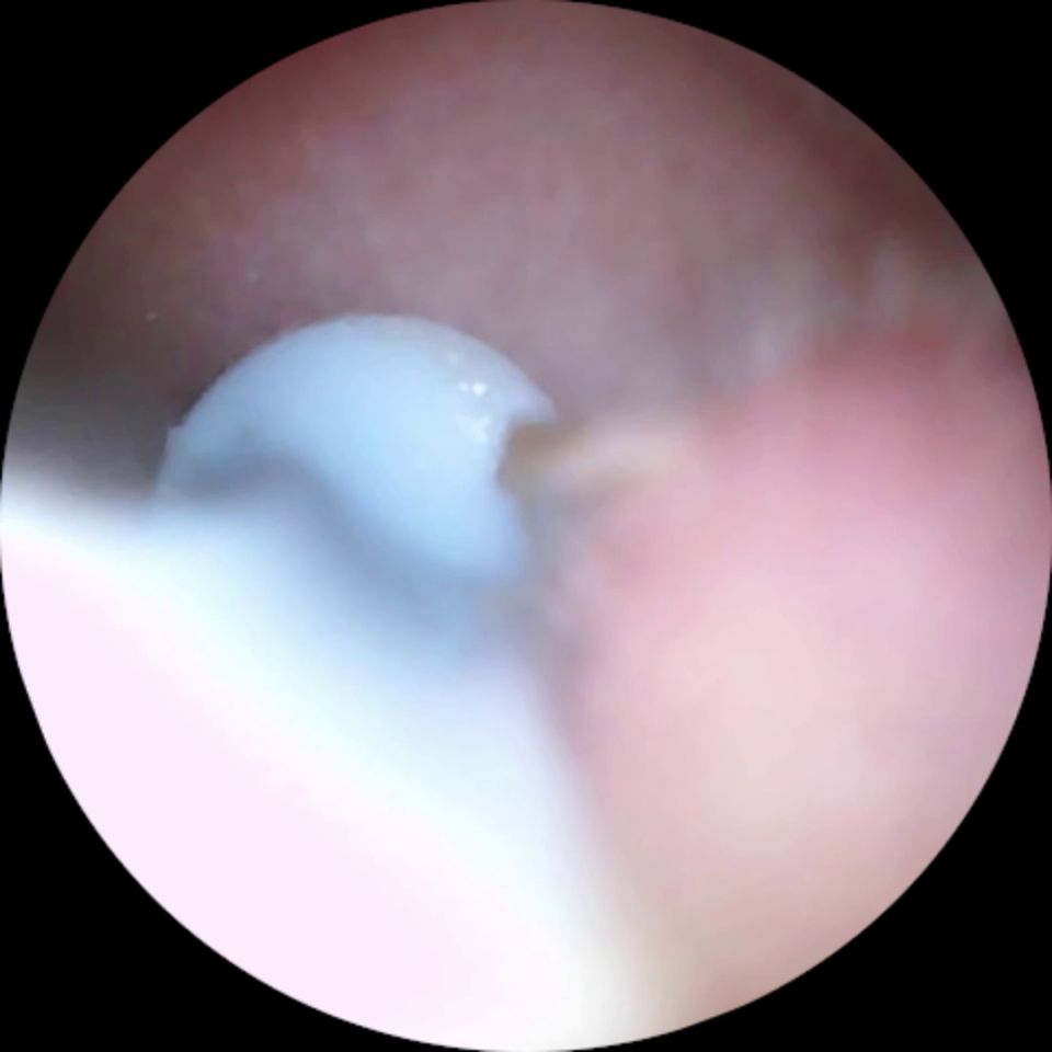 [ManyVids] Longhairluna Manyvids.23.12.09.Longhairluna.Ear.Wax.Cleaning 