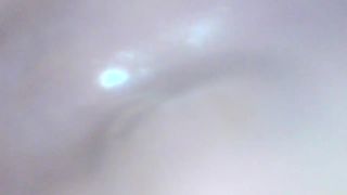 Milly17 gapig pussy endoscope exploration smalltits 