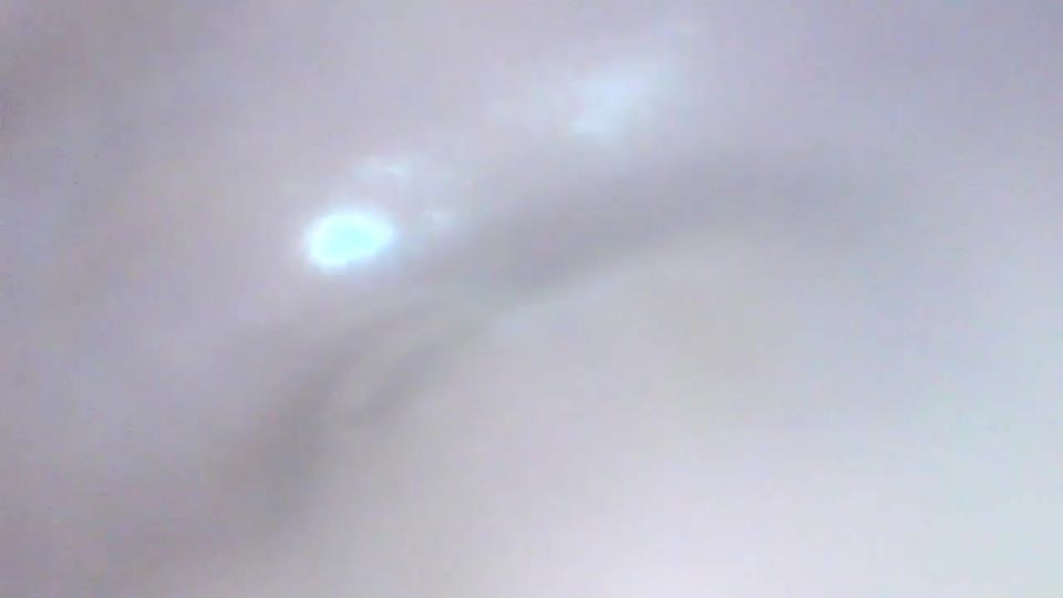 Milly17 gapig pussy endoscope exploration smalltits 