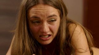 Whip strokes on sunburnt skin - part 4 1080P - Dr.lomp