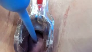 free porn video 22 lesbian nose fetish anal porn | Show with cervix opened with speculum | speculum