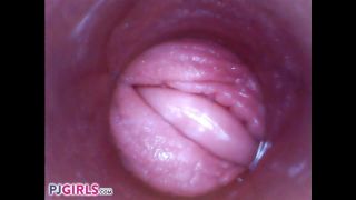 free video 9 RAW Endoscopic Video on anal porn big babe anal