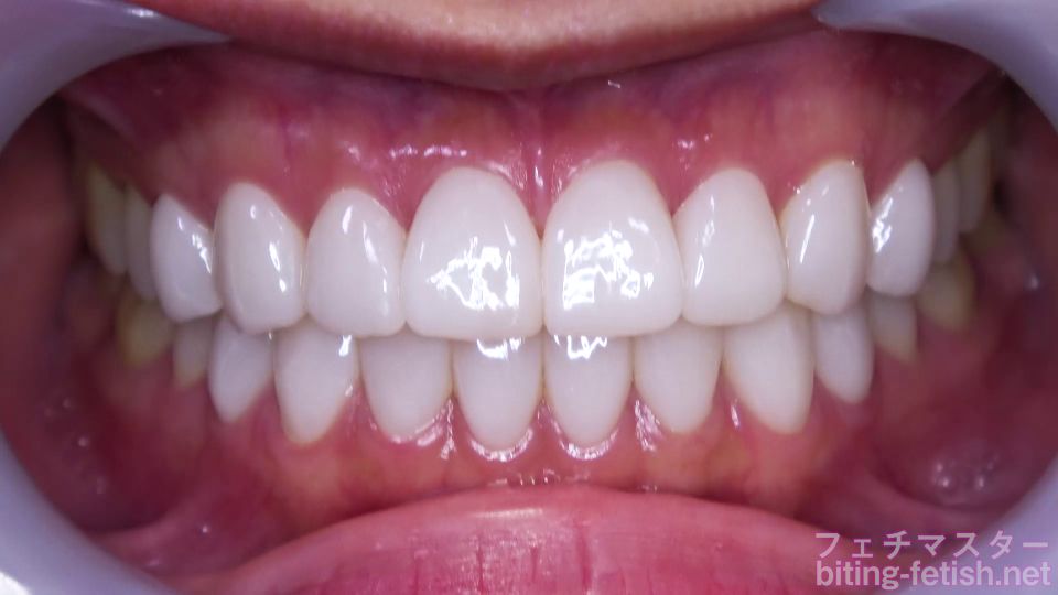 xxx clip 47 money fetish Japanese Asian Biting Mouth Fetish – Yuno Kisaragi Watching Inside Mouth Of Japanese Cute Girl, jerkoff instructions on fetish porn